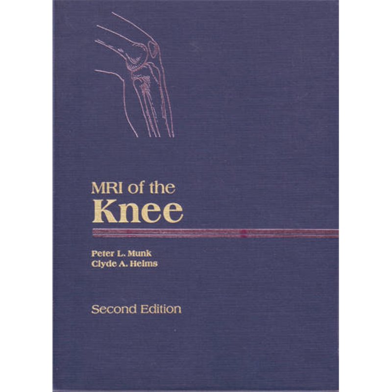 MRI of the Knee - Second Edition